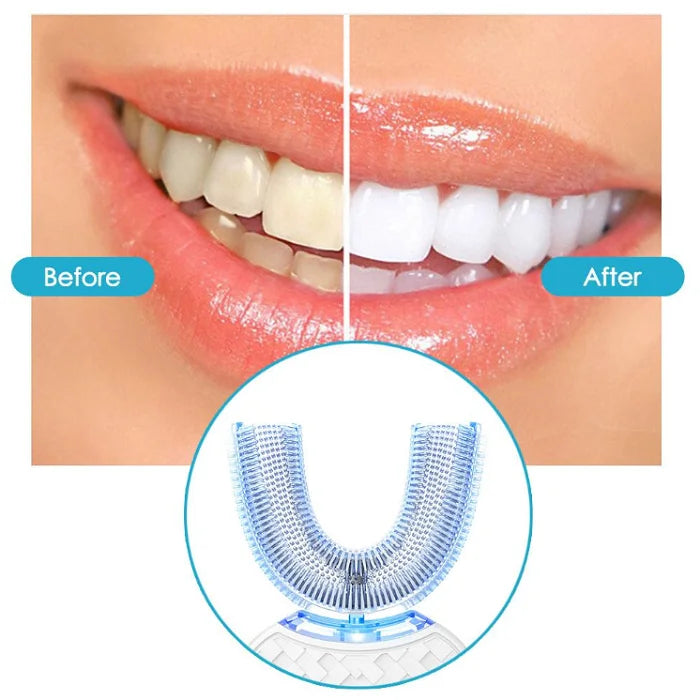 Portable Wireless Charging U Shaped 360 Degree Automatic Electric Toothbrush with Silicone or Bristle Heads