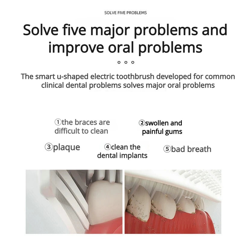 U-Shaped Sonic Electric Toothbrush - Rechargeable Silicone U-Brush Vibrating Teeth Cleaner, Waterproof Ultrasonic Dental Care